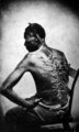 A korbács nyomai egy amerikai rabszolga hátán